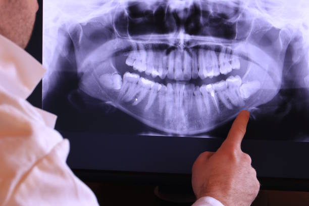 Best Dentist for Tooth Abscess  in Lancaster, PA